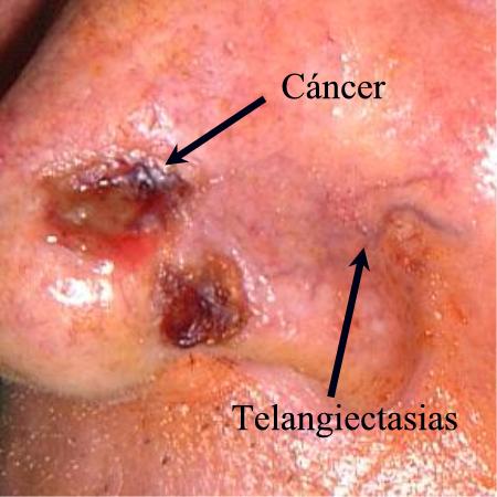 ¿Cómo conseguir un bronceado natural sin Sol ni rayos UVA?