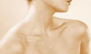 Cuello